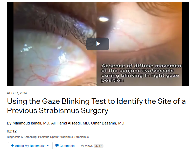 Using the Gaze Blinking Test to Identify the Site of a Previous Strabismus Surgery